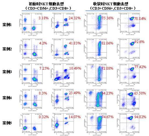 NKT细胞培养案例分享.png NKT细胞培养案例分享.png